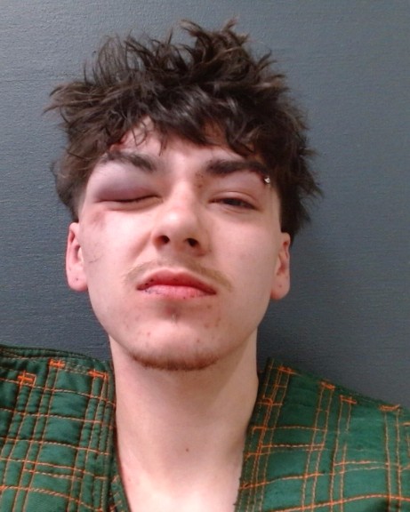 MCKAY, XANDER GRAYSON booking photo