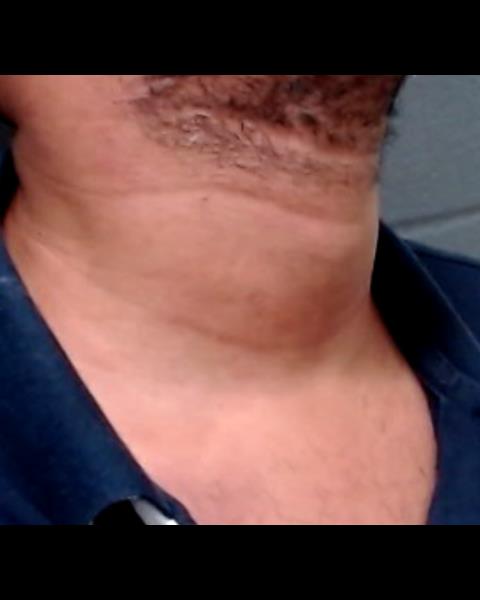 BRITTON, PATRICK RONALD booking photo