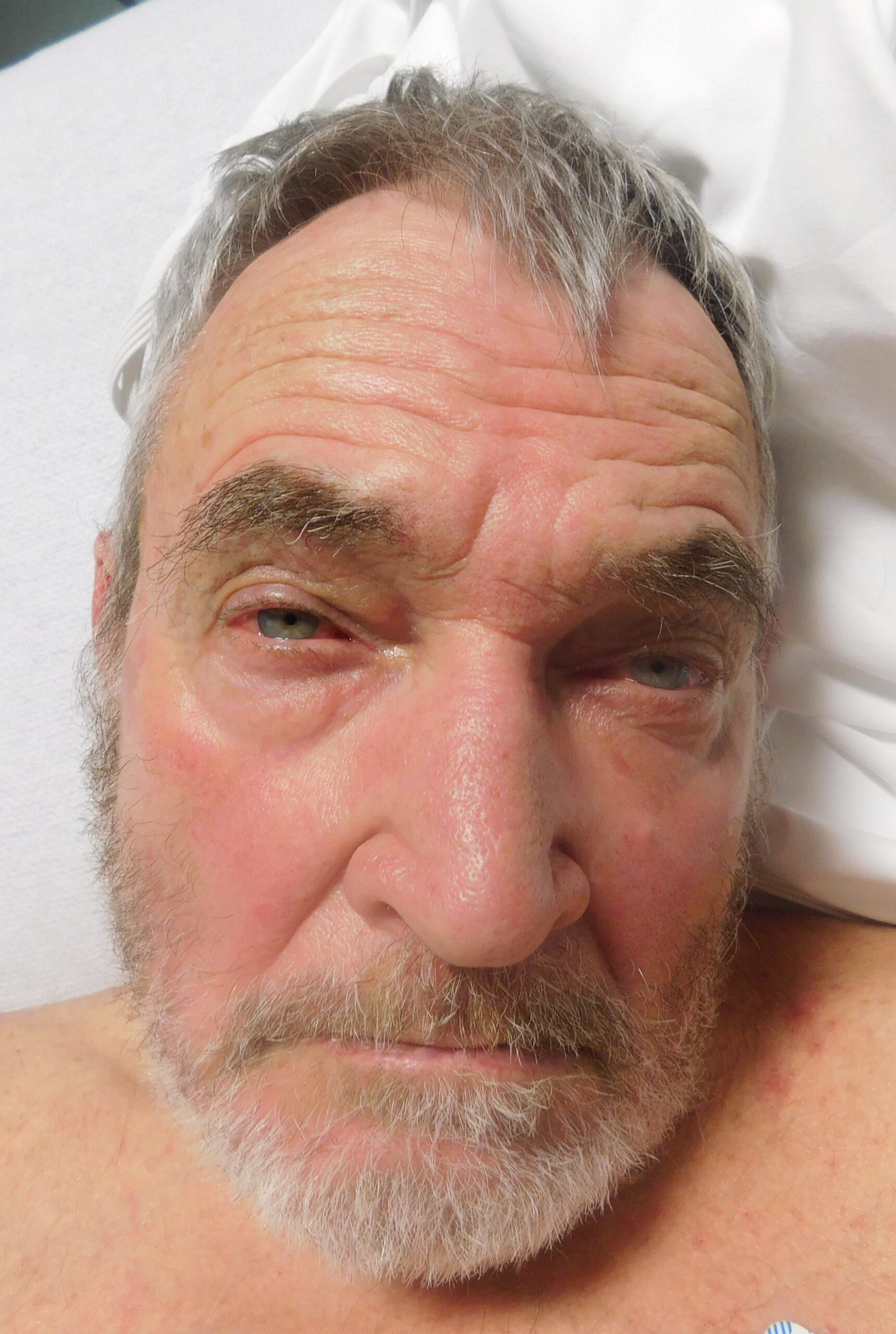 LYONS, RICHARD PAUL booking photo